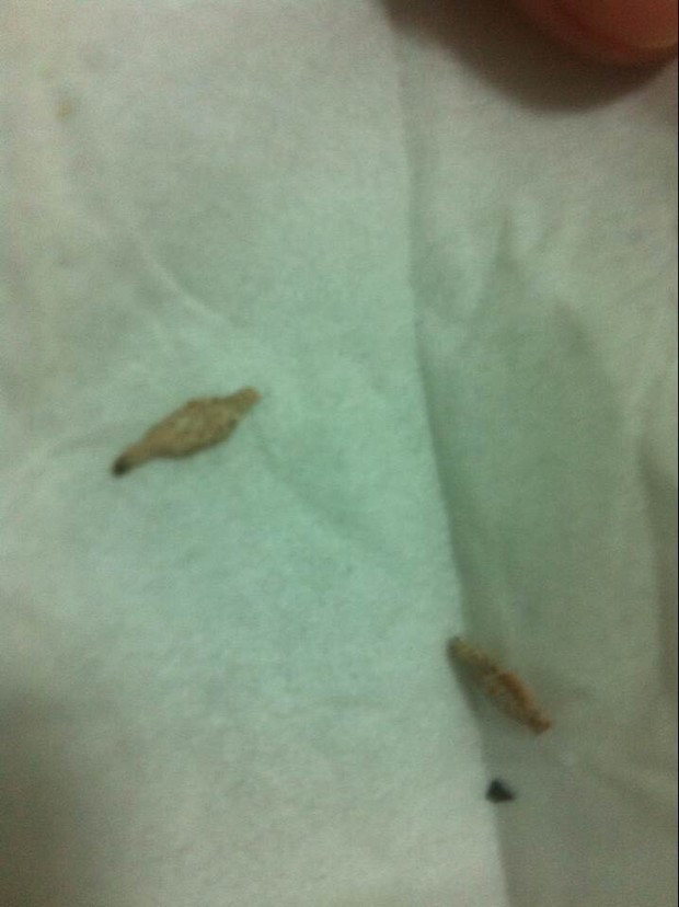 家里有虫卵,壳体像棉,头部在一段拖着壳体爬行,是什么虫