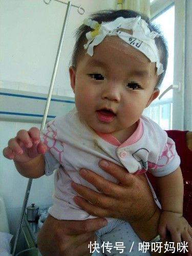 2岁半宝宝不会走路,医生告知原因后,一家人肠