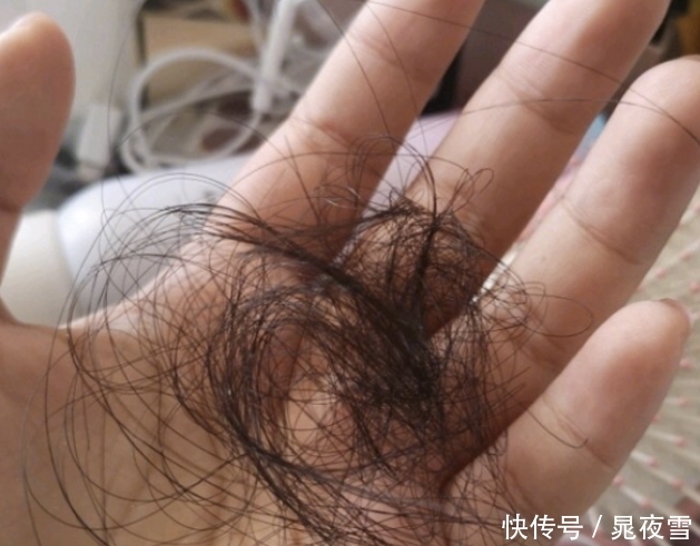 我国发明一“脱发克星”洗发水,4周解决脱发、油腻,接发要下岗了 澳门凯旋门娱乐平台