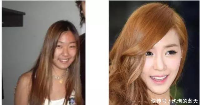 在韩国没有长得丑的明星,只有不愿意花钱去改