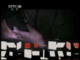 健康之路 黄脸老汉胰腺癌