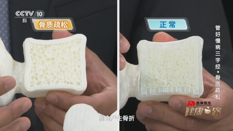 健康之路 《健康之路》 20240825 管好慢病三字经·骨质疏松