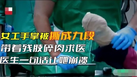女工人的手掌被撕碎成九段，带着残肢求医，医生一句话让她崩溃