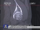 军事报道 《军事报道》 20150106