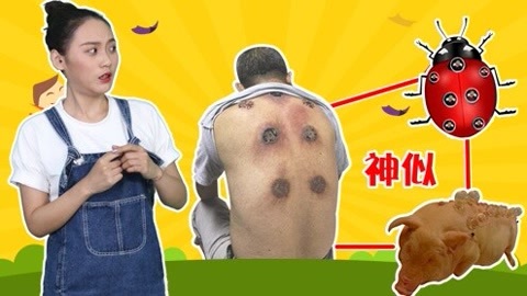 囧闻一箩筐 拔罐老汉惊变“瓢虫怪”
