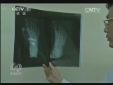 焦点访谈 《焦点访谈》 20131207 “外国小伙遭讹”真相/考试招生制度怎么改