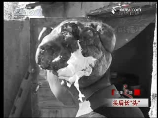 健康之路 头后长 头