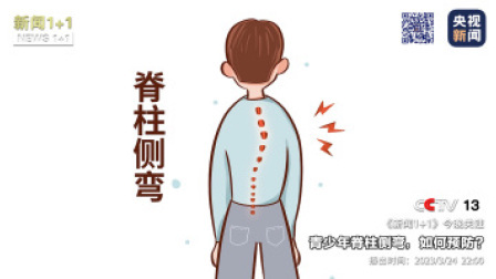 新闻1+1 2023 新闻1+1 青少年脊柱侧弯，如何预防？