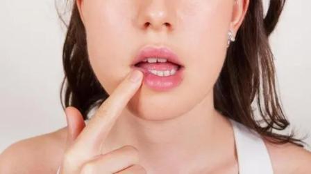健康之路 口腔溃疡一直不好？原来是不分体质吃错药