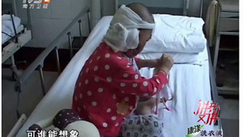 讲开又讲之被狗咬毁容女孩 将进行整形治疗