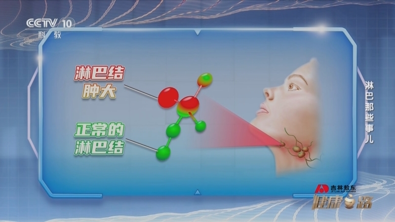 健康之路 《健康之路》 20240115 淋巴那些事儿