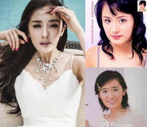 盘点女星换脸式整容,郑爽耿直承认,最服温碧霞!