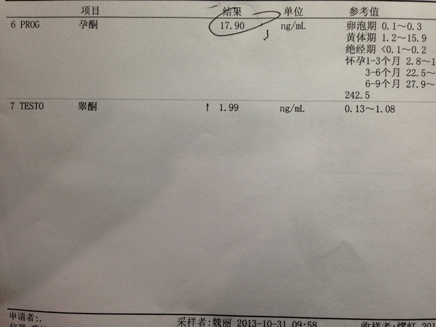 懷孕7周,檢查單顯示孕酮17.9,睪酮1.99.