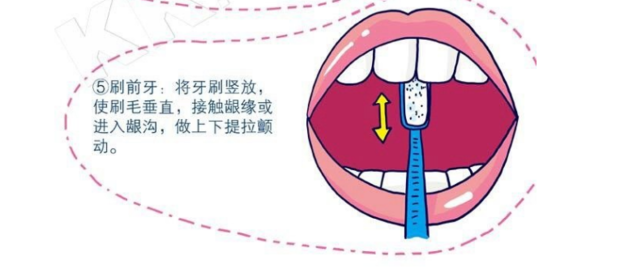 掌握正確的刷牙方法圖解巴氏bass刷牙法